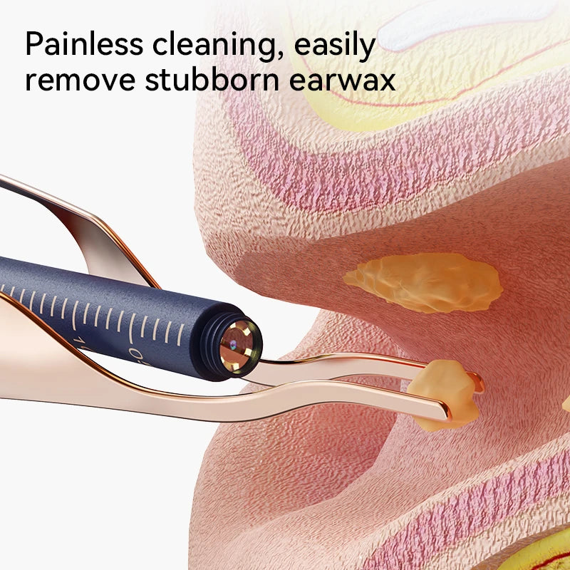 Smart Visual Ear Wax Cleaner With Camera 800W HD Entige