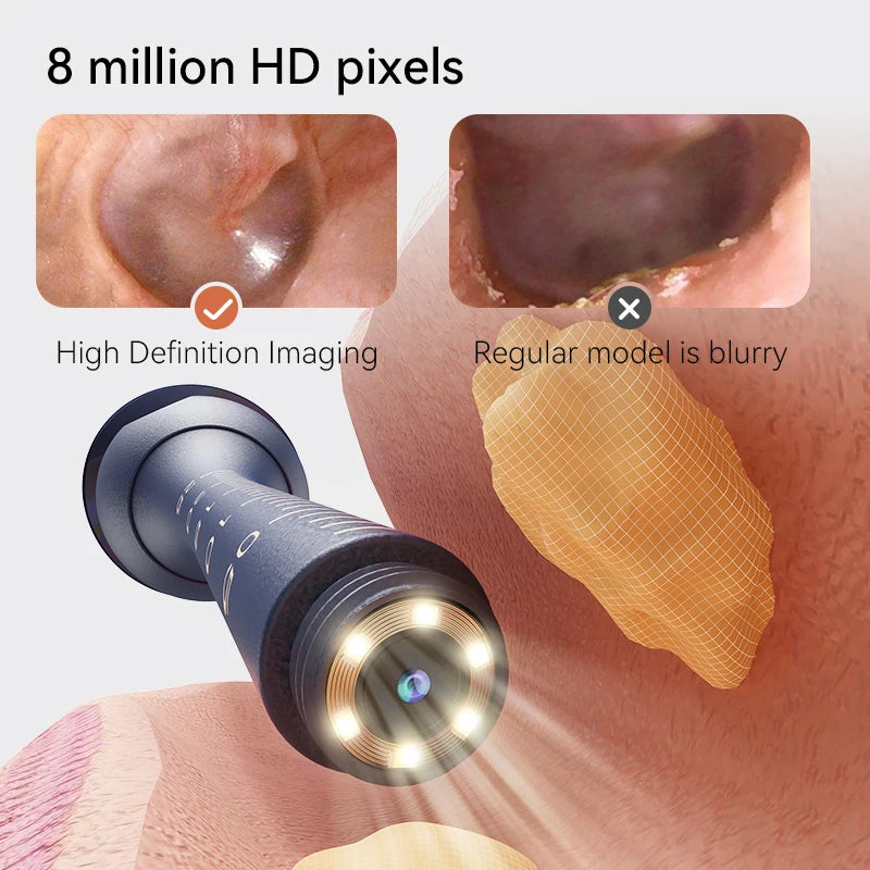 Smart Visual Ear Wax Cleaner With Camera 800W HD Entige