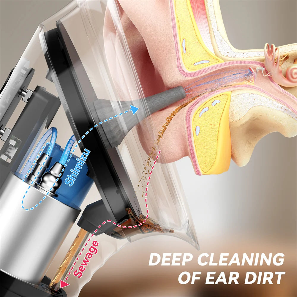 Electric Ear Wax Removal Kit | 3 Pressure Settings & 11 Tips